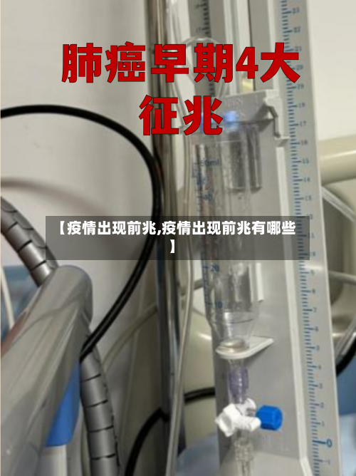 【疫情出现前兆,疫情出现前兆有哪些】-第2张图片