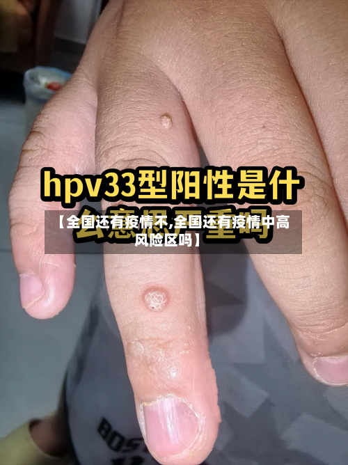 【全国还有疫情不,全国还有疫情中高风险区吗】