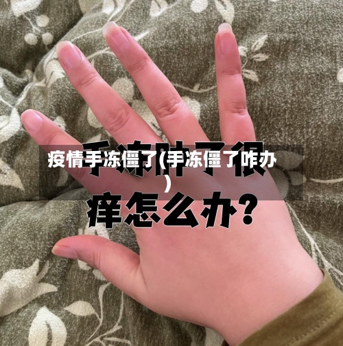 疫情手冻僵了(手冻僵了咋办)-第3张图片