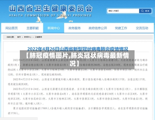 【肺冠疫情图片,肺炎冠状病毒最新情况】-第2张图片