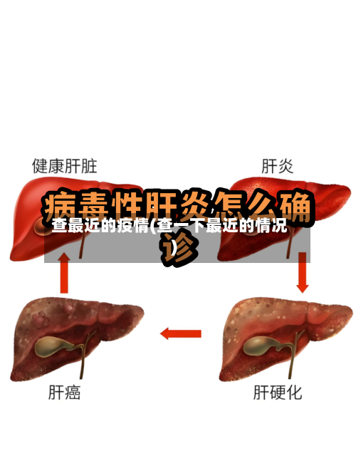 查最近的疫情(查一下最近的情况)-第2张图片